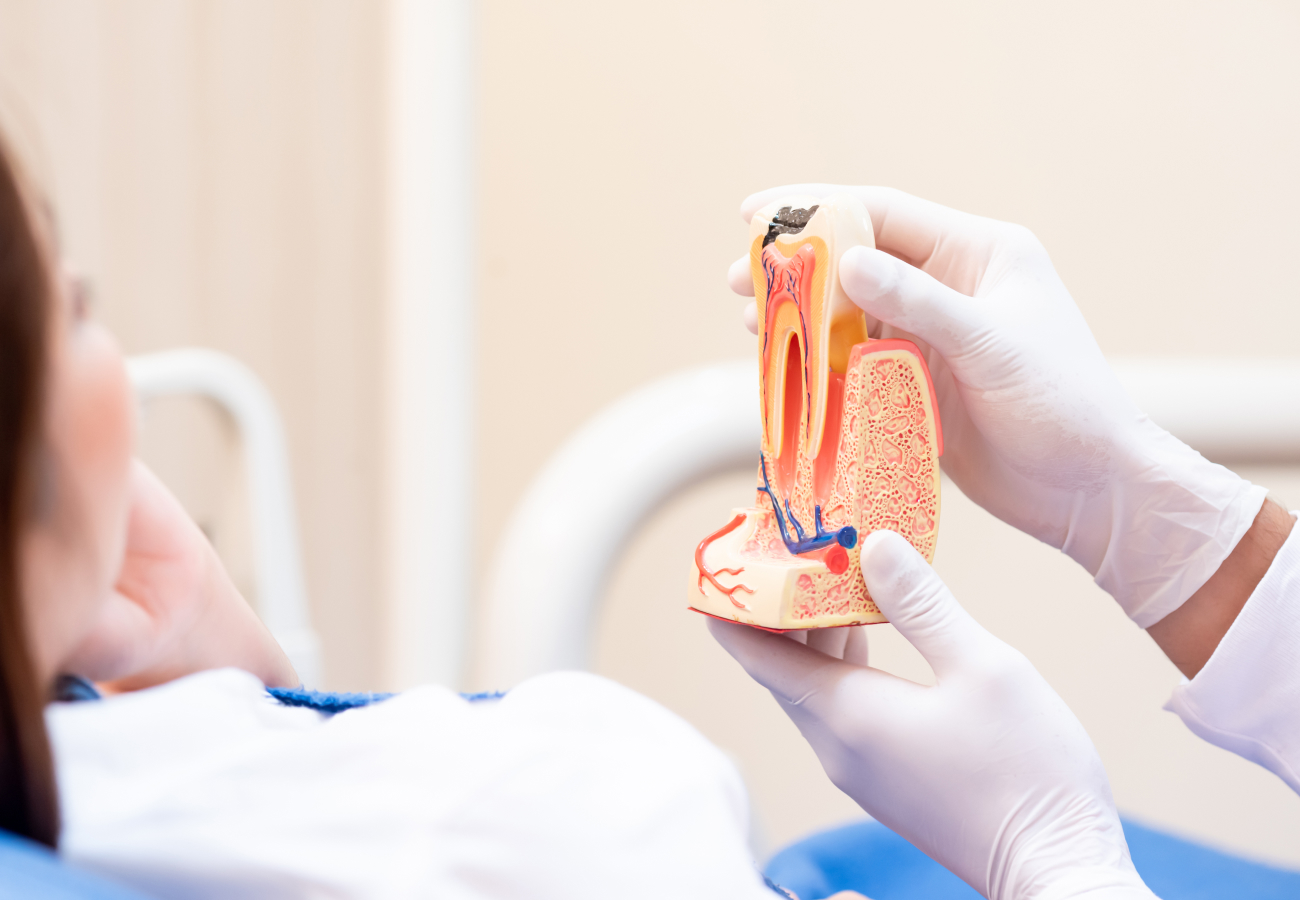 Root Canal Therapy